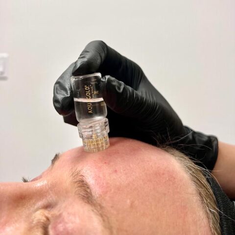 aqua gold injectable