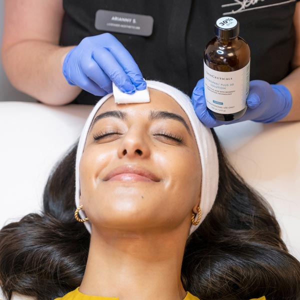 chemical peel
