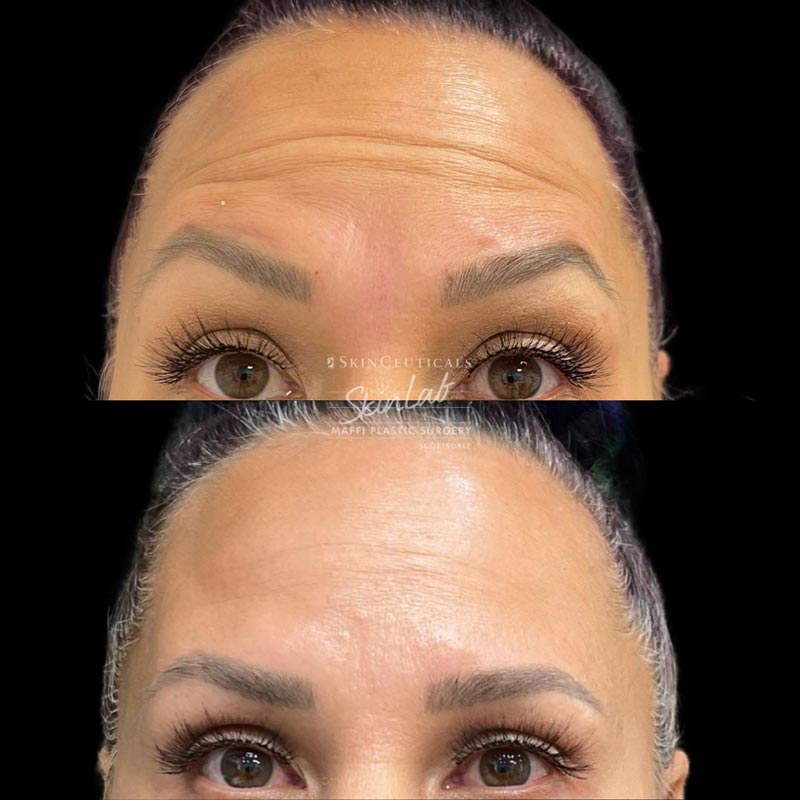 DR.-TERRY-MAFFI---surgery-before-and-afters-(14)