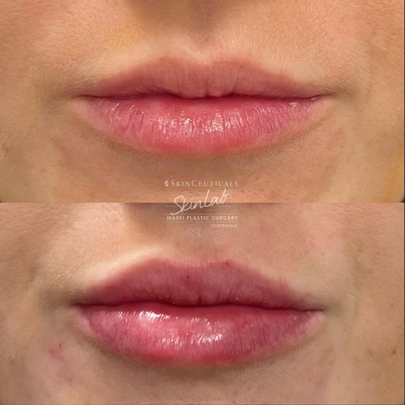 DR.-TERRY-MAFFI---surgery-before-and-afters-(16)