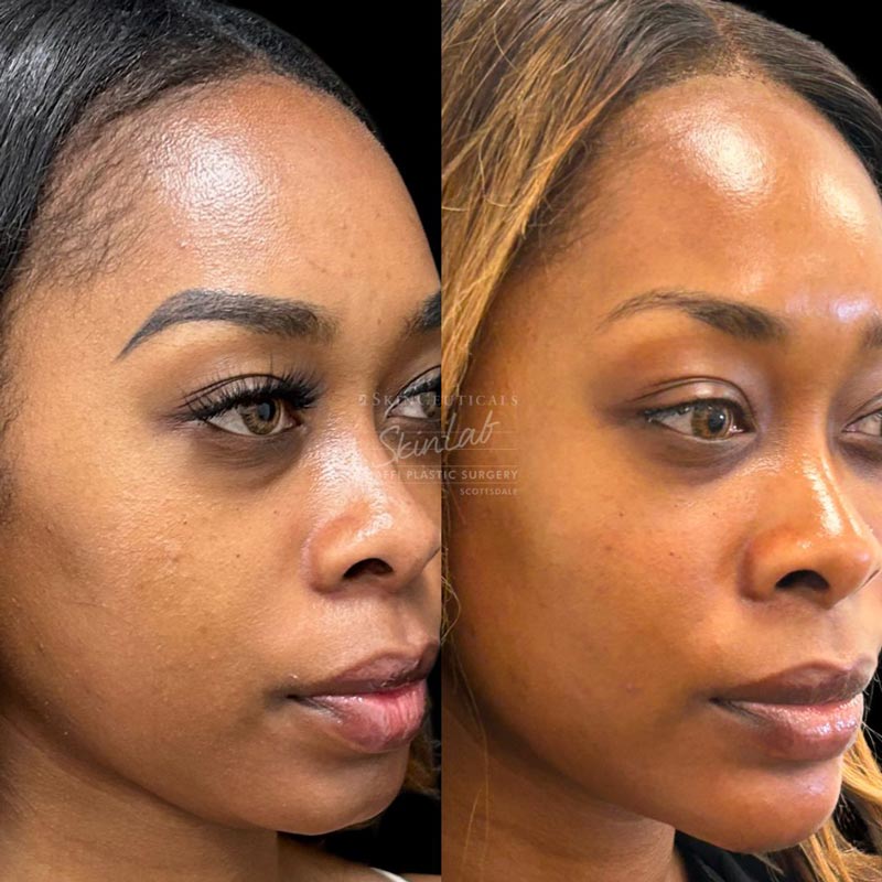 SkinFirm Signature Treatment